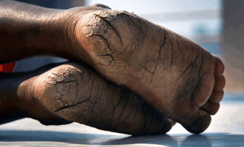 Yoga & Embodiment: Collected Notes on Existing as a Body