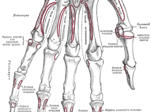 What You Need to Know – Rachel Scott